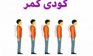 درمان گودی کمر با ورزش