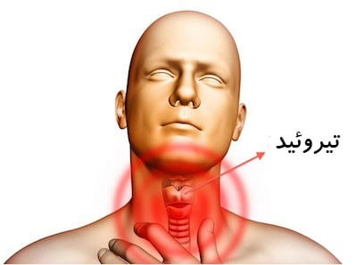 کم کاری تیروئید و علل و درمان