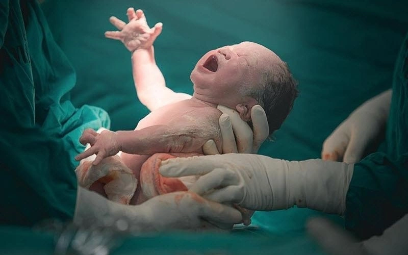 زایمان طبیعی بهتره یا سزارین؟ یا زایمان طبیعی درد داره؟ زایمان طبیعی بهتره یا سزارین؟ یا زایمان طبیعی درد داره؟