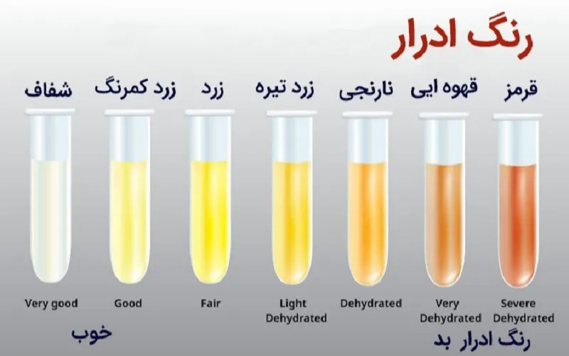 رنگ ادرار: راهنمای جامع تشخیص سلامتی از روی رنگ ادرار شما رنگ ادرار: راهنمای جامع تشخیص سلامتی از روی رنگ ادرار شما