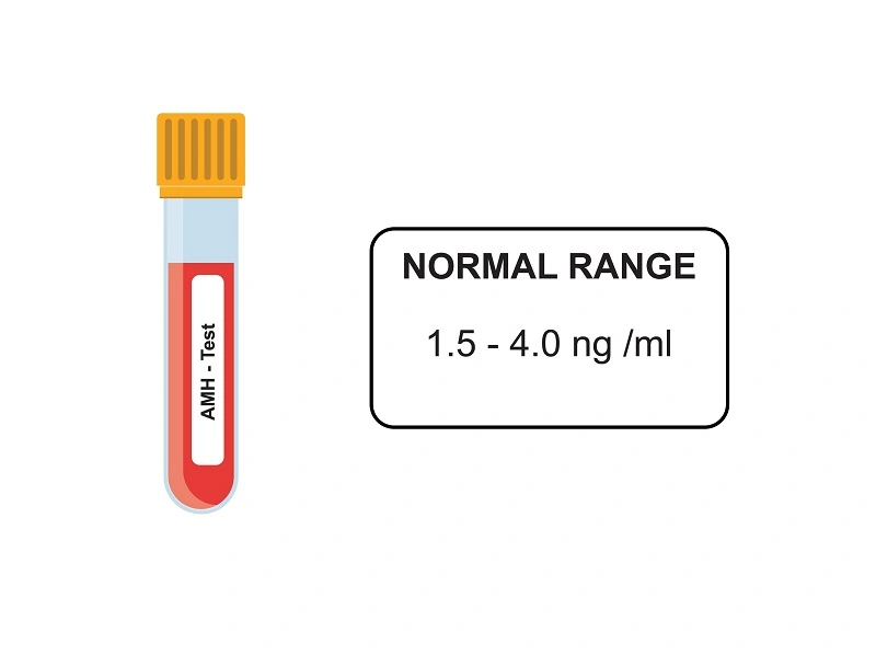 پروژسترون (در فاز لوتئال): برای تأیید وقوع تخمک‌گذاری