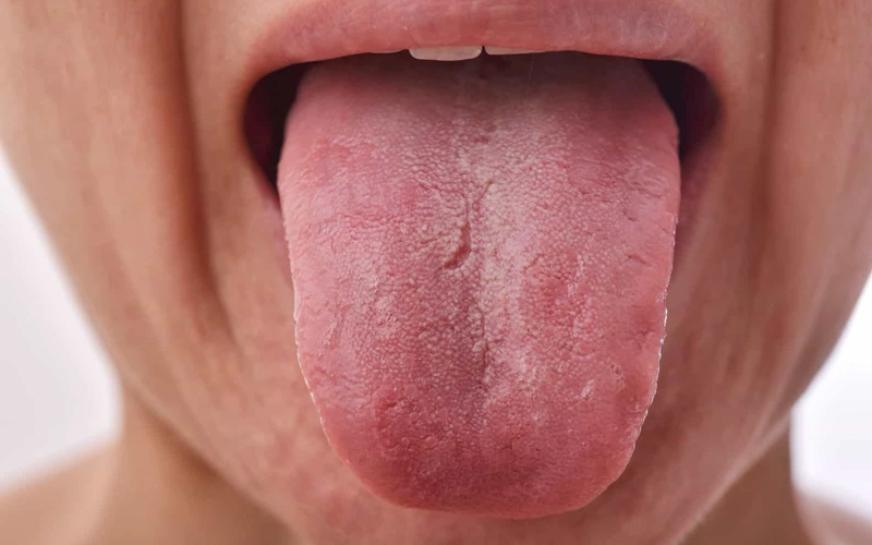 خطر کم خونی خاموش: ۱۰ علامت هشداردهنده کم خونی را بشناسید (تشخیص سریع)