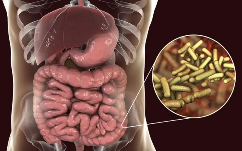 سریع‌ترین راه‌های درمان اسهال خونی در خانه + داروهای ضروری