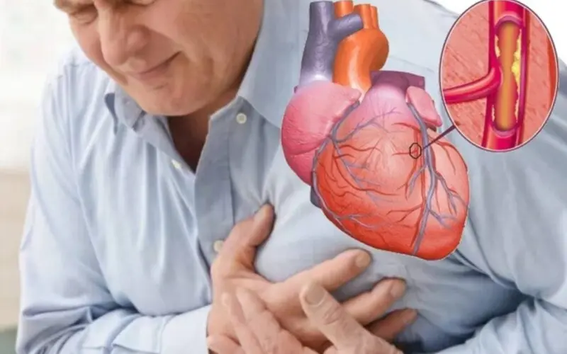 سکته قلبی؛ علائم واضح و نشانه‌های پنهانی که نباید نادیده بگیرید