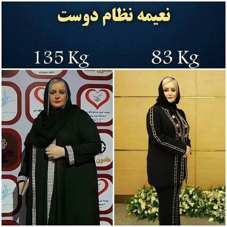 عکس قبل و بعد نعیمه نظام‌دوست